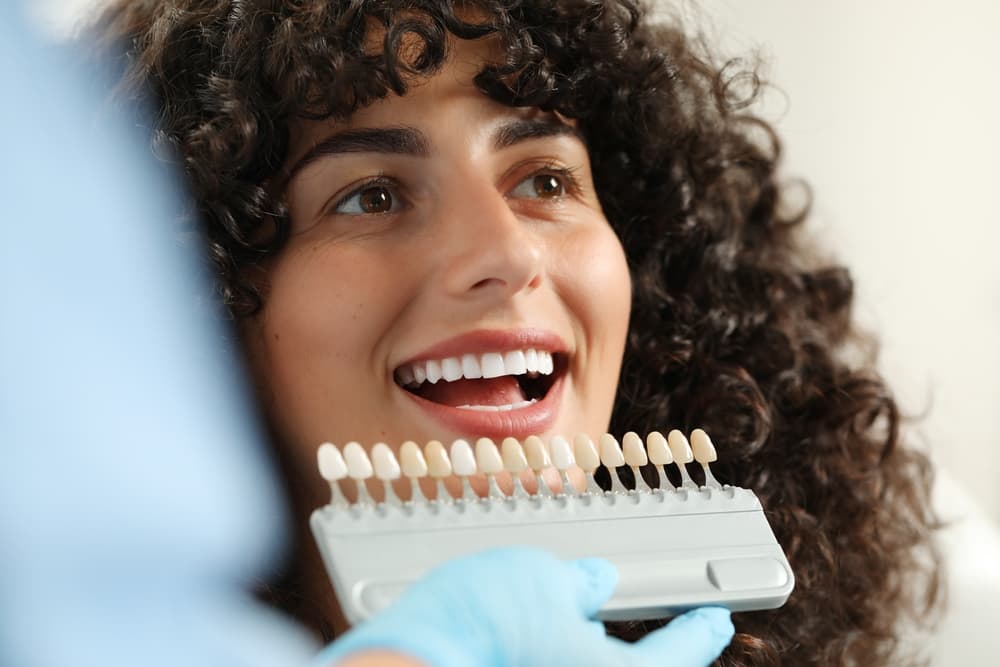 Dental Veneers