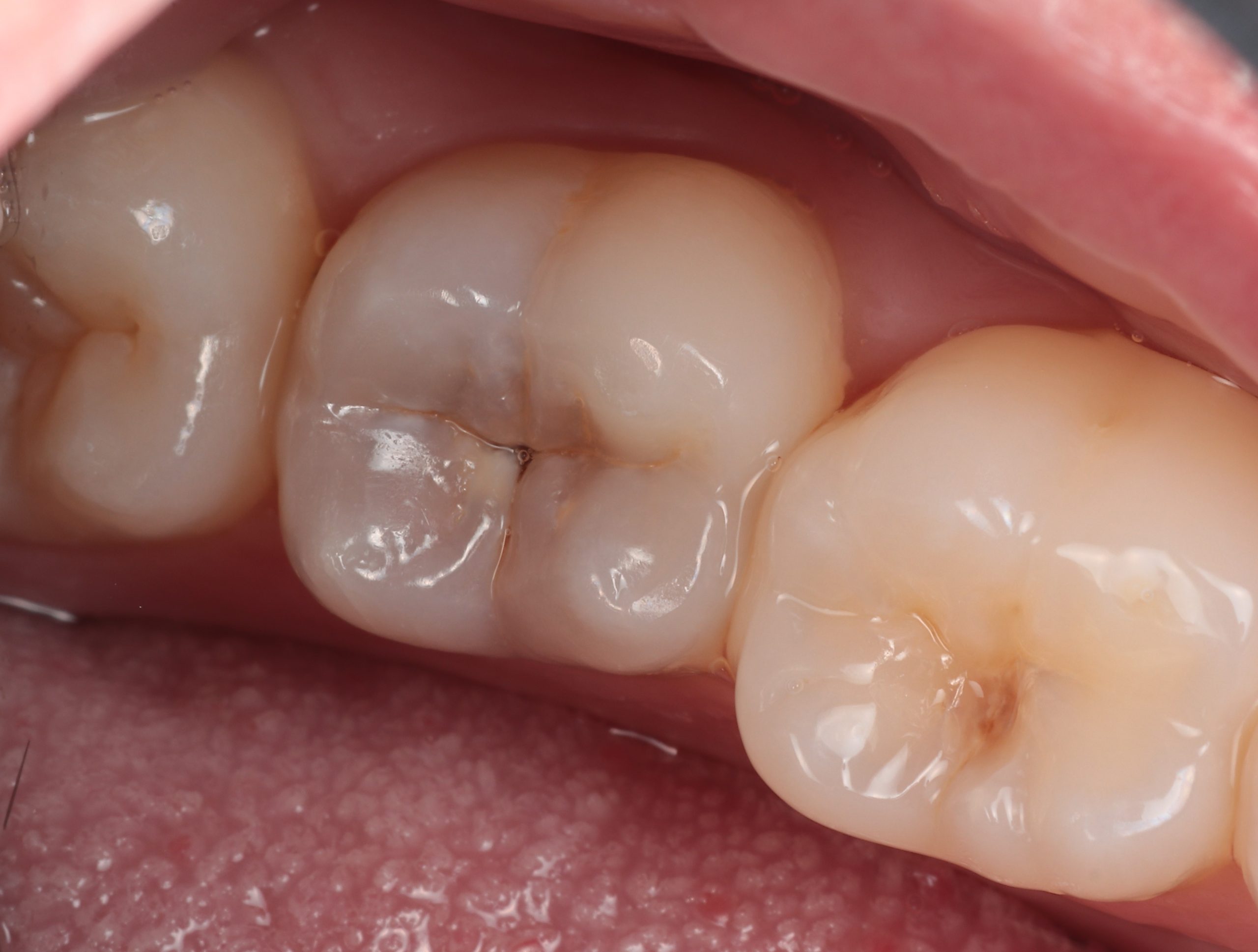 dental check-up Southampton